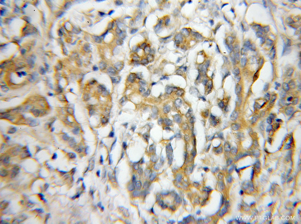 IL-17RE Polyclonal antibody