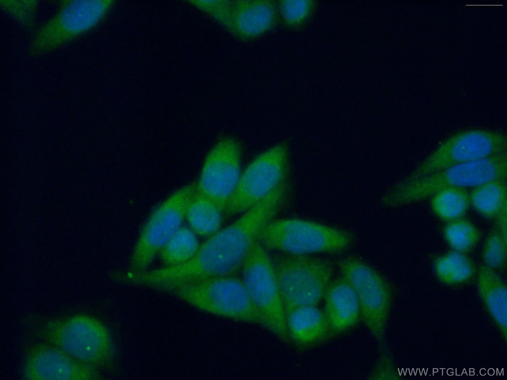 PRTFDC1 Polyclonal antibody