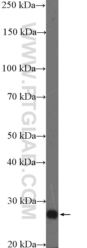 TCEAL1 Polyclonal antibody