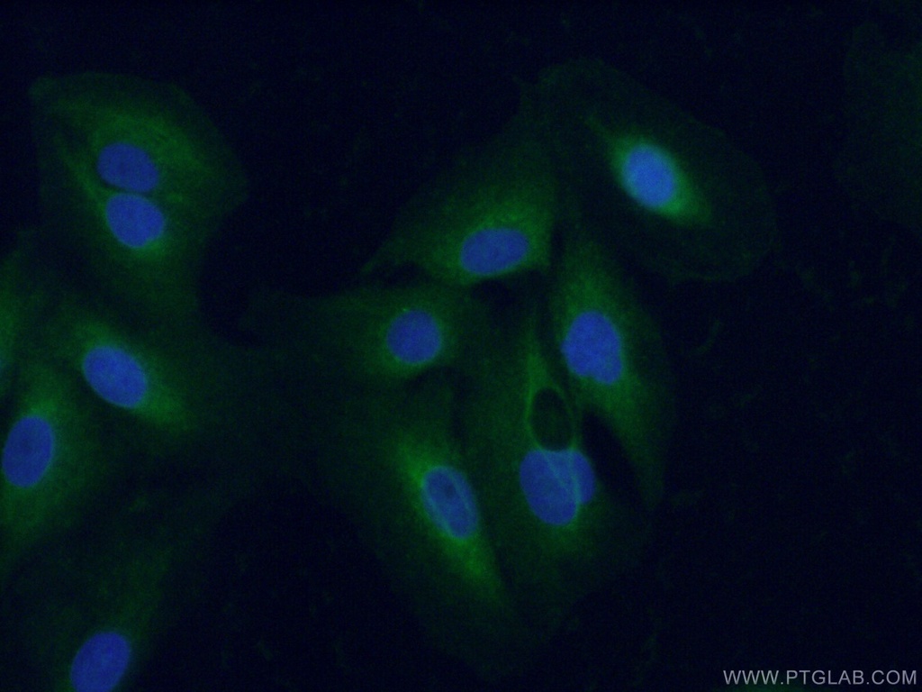 TrkC Polyclonal antibody