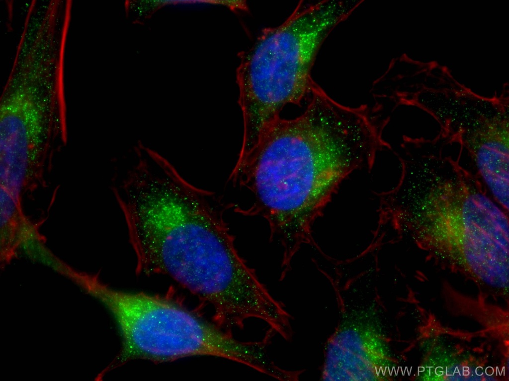 VPS45 Polyclonal antibody