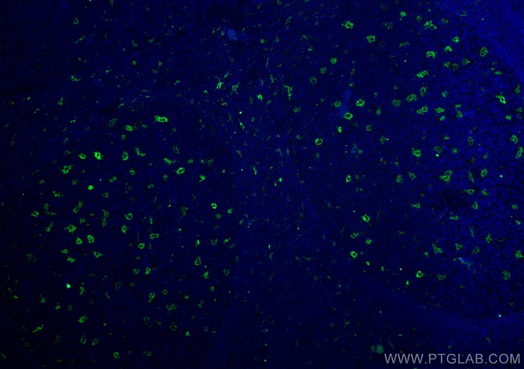 TIMD4 Polyclonal antibody