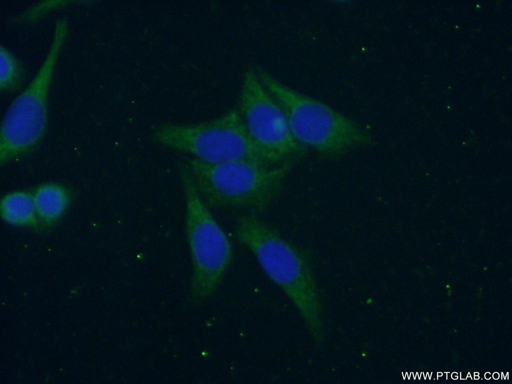 CAMP Polyclonal antibody