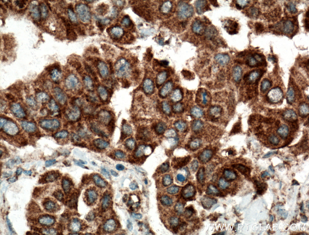 SMYD3 Polyclonal antibody