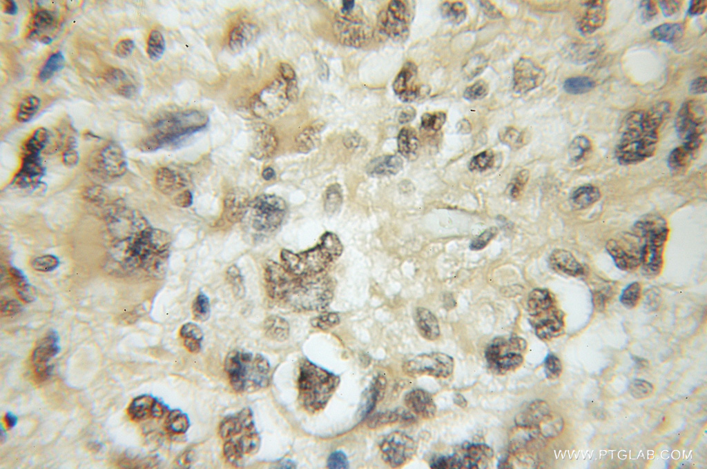 Exo70 Polyclonal antibody
