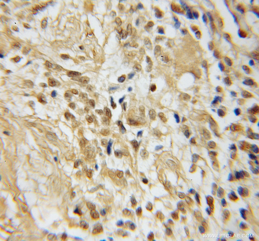 TFAP4 Polyclonal antibody