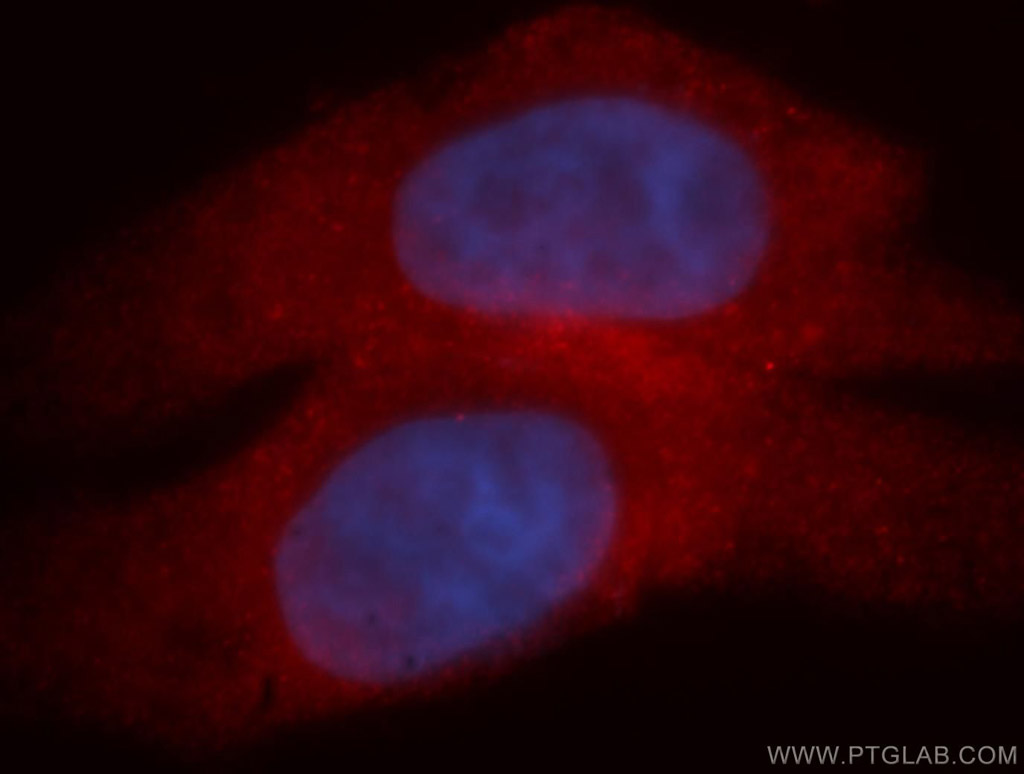 MYCBP Polyclonal antibody