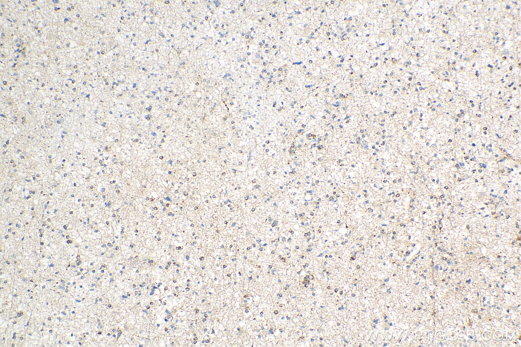 STMN4 Polyclonal antibody