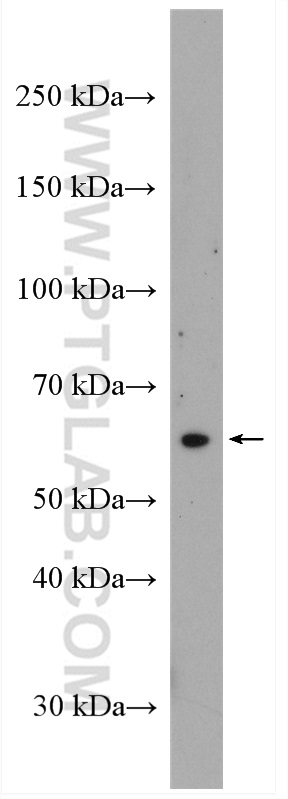 STT3A Polyclonal antibody