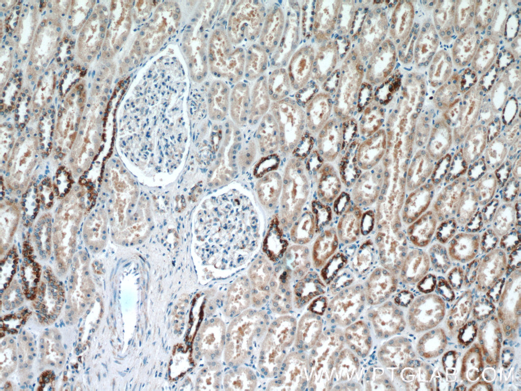 KIF12 Polyclonal antibody