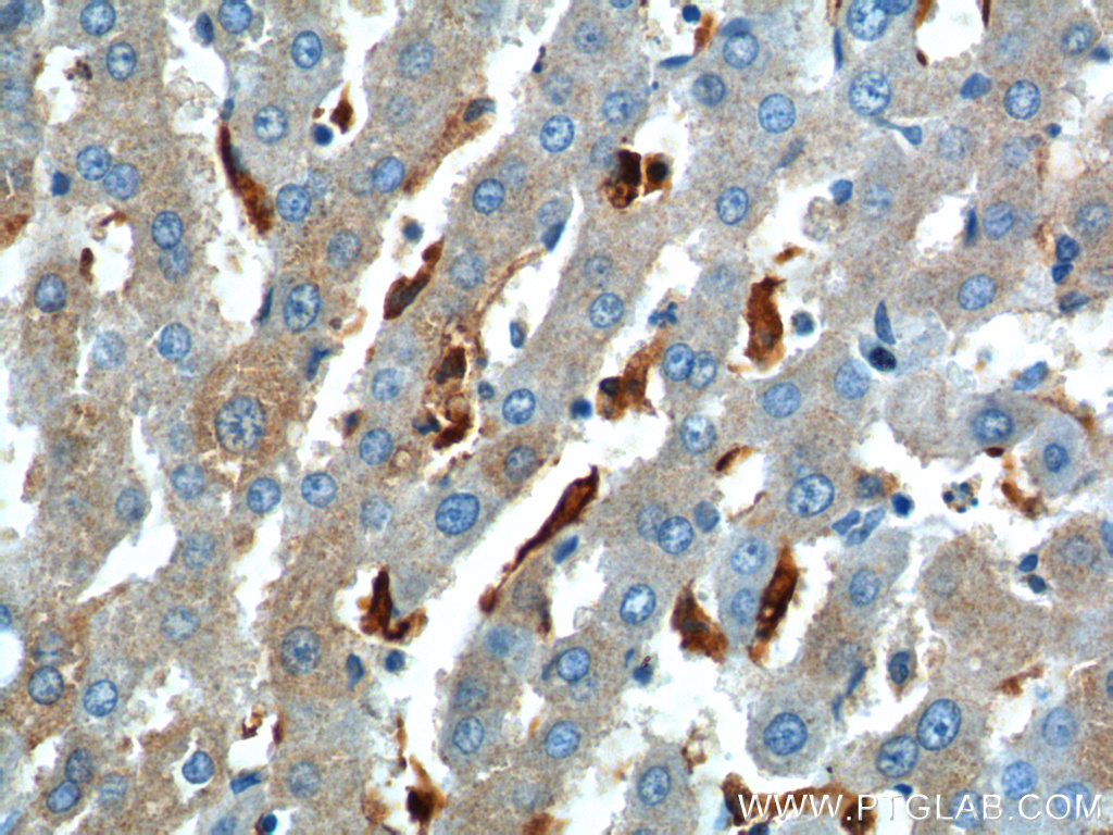 CHI3L1/YKL40 Polyclonal antibody