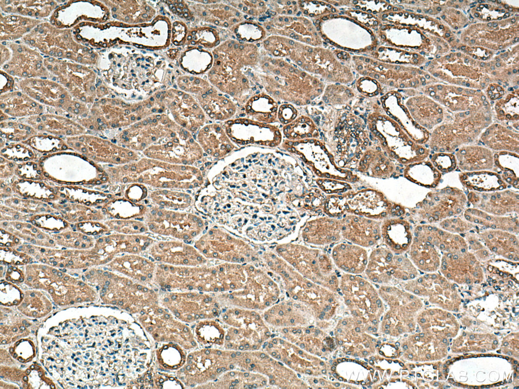 DISP1 Polyclonal antibody