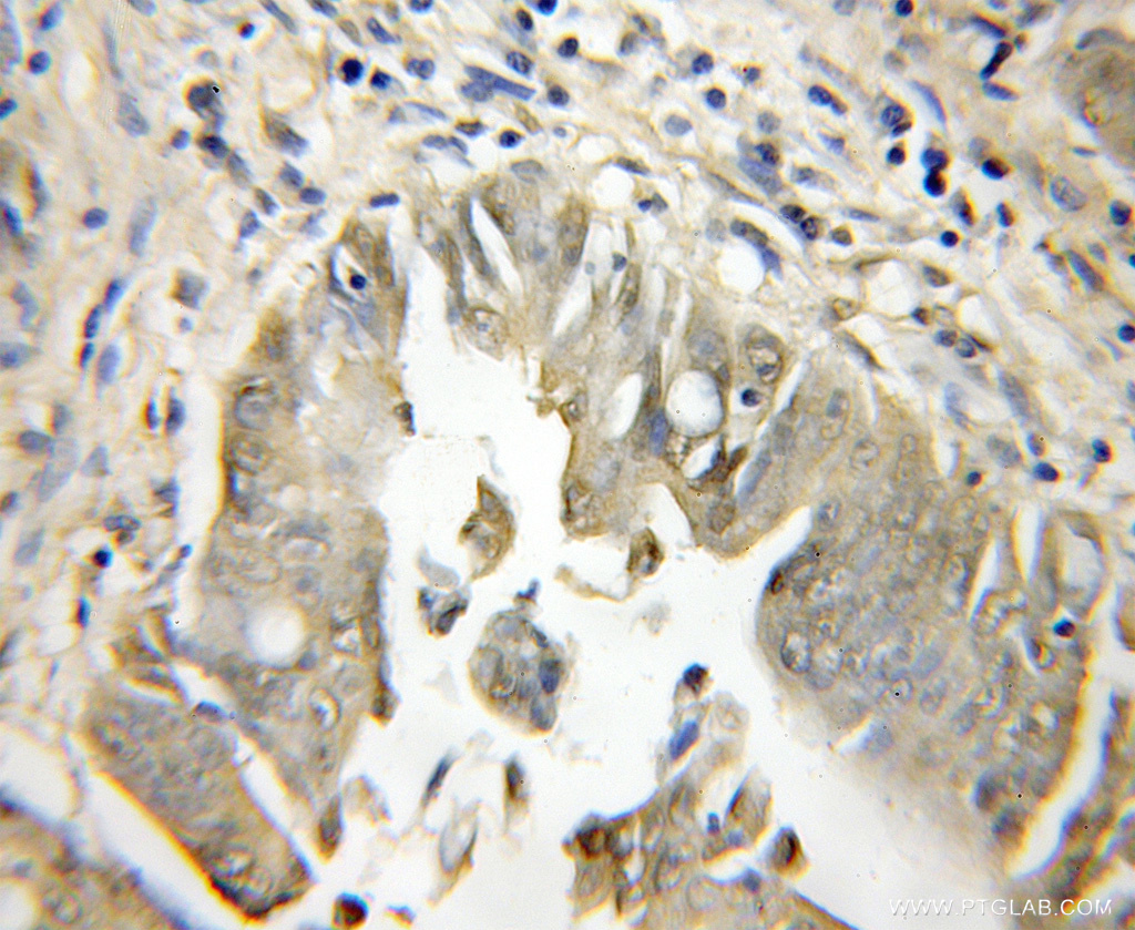 PCSK7 Polyclonal antibody
