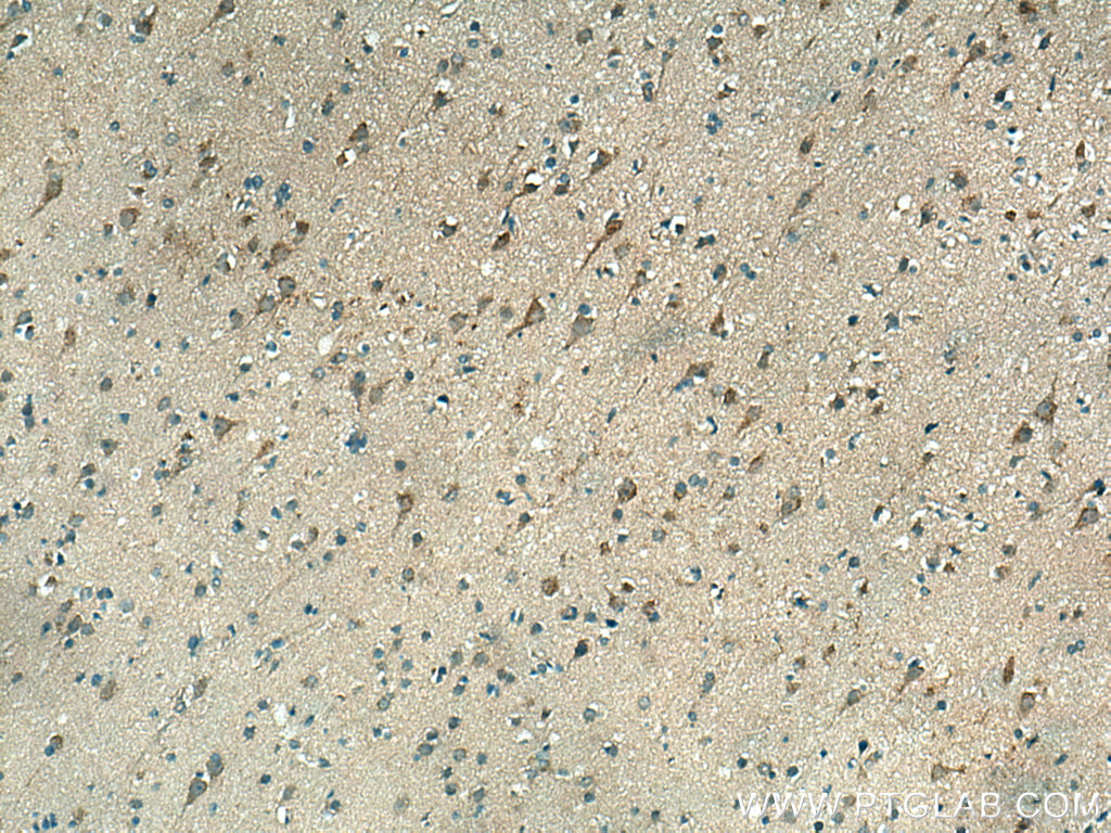 CHN1 Polyclonal antibody