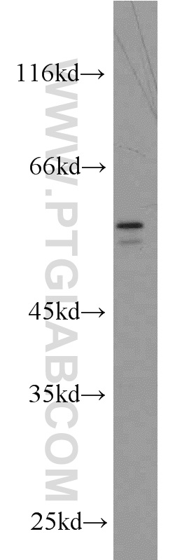 BRF2 Polyclonal antibody