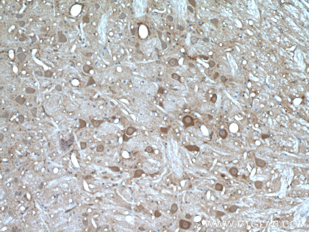 PYGB Polyclonal antibody