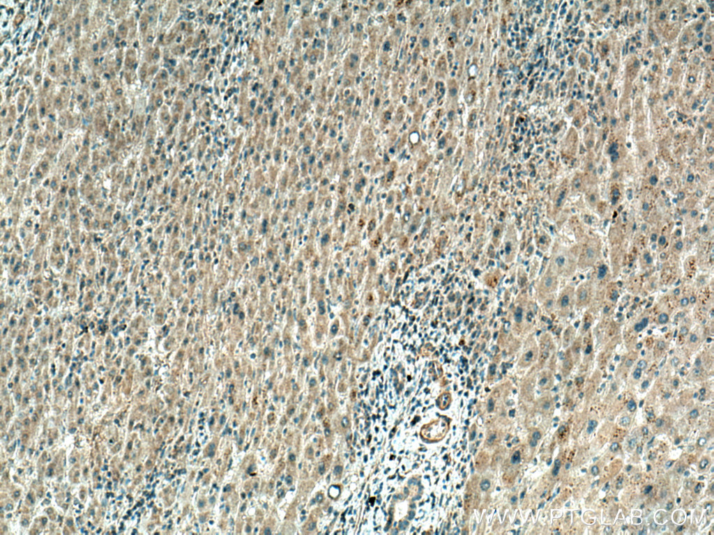 TINAGL1 Polyclonal antibody