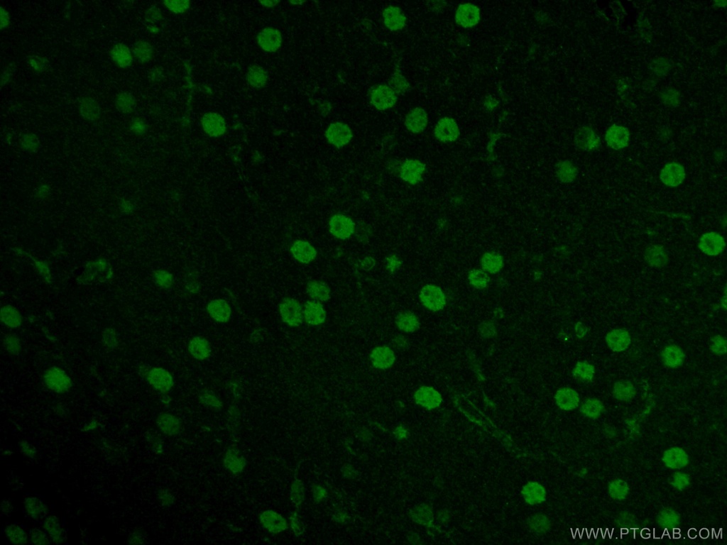 NEUROD1 Polyclonal antibody