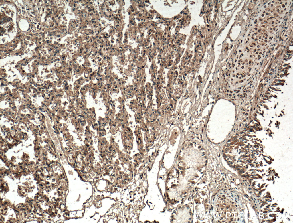 SLC25A10 Polyclonal antibody