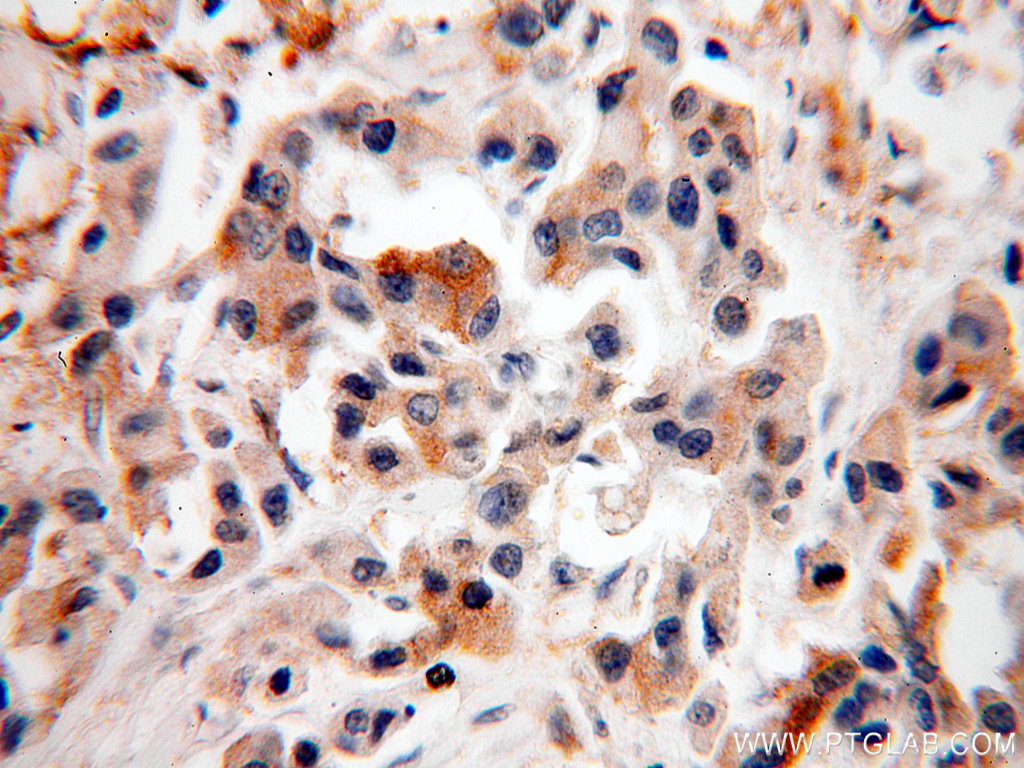 SRPR Polyclonal antibody