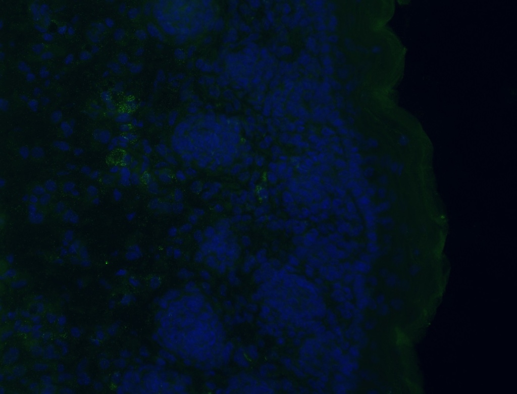 G0S2 Polyclonal antibody