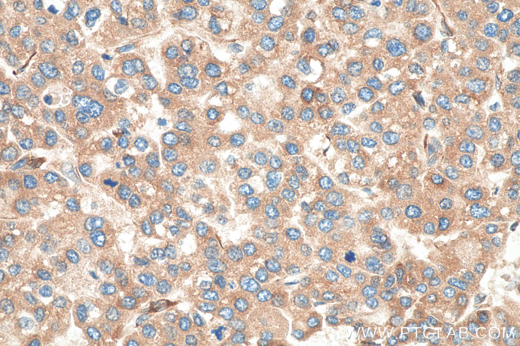 FKBP7 Polyclonal antibody