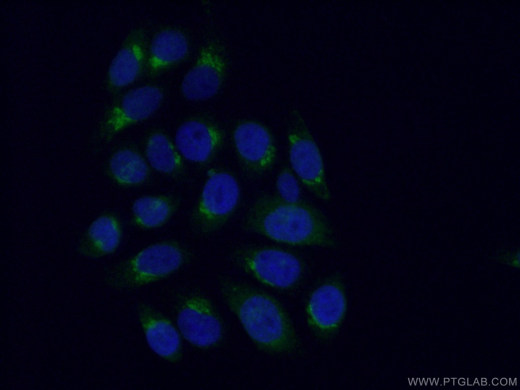 GOSR2/Membrin Polyclonal antibody