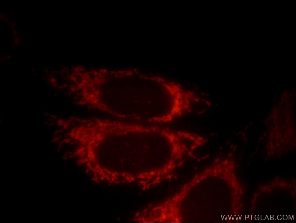 DNAJC19 Polyclonal antibody