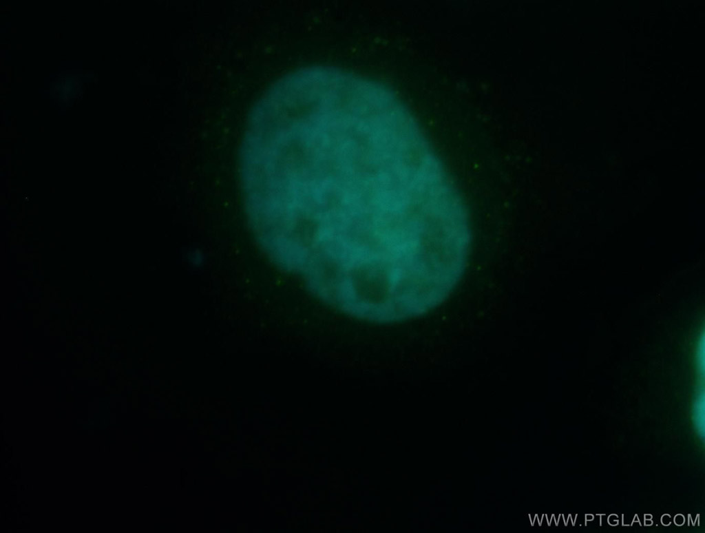 UBLCP1 Polyclonal antibody