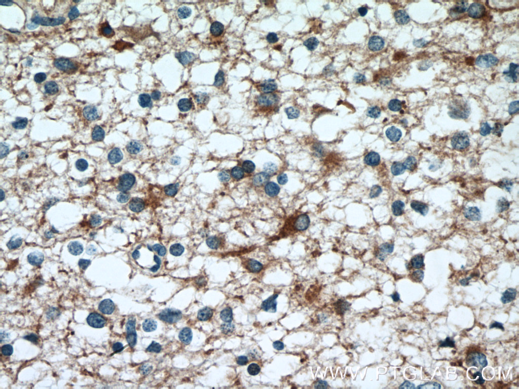FEZ1 Polyclonal antibody