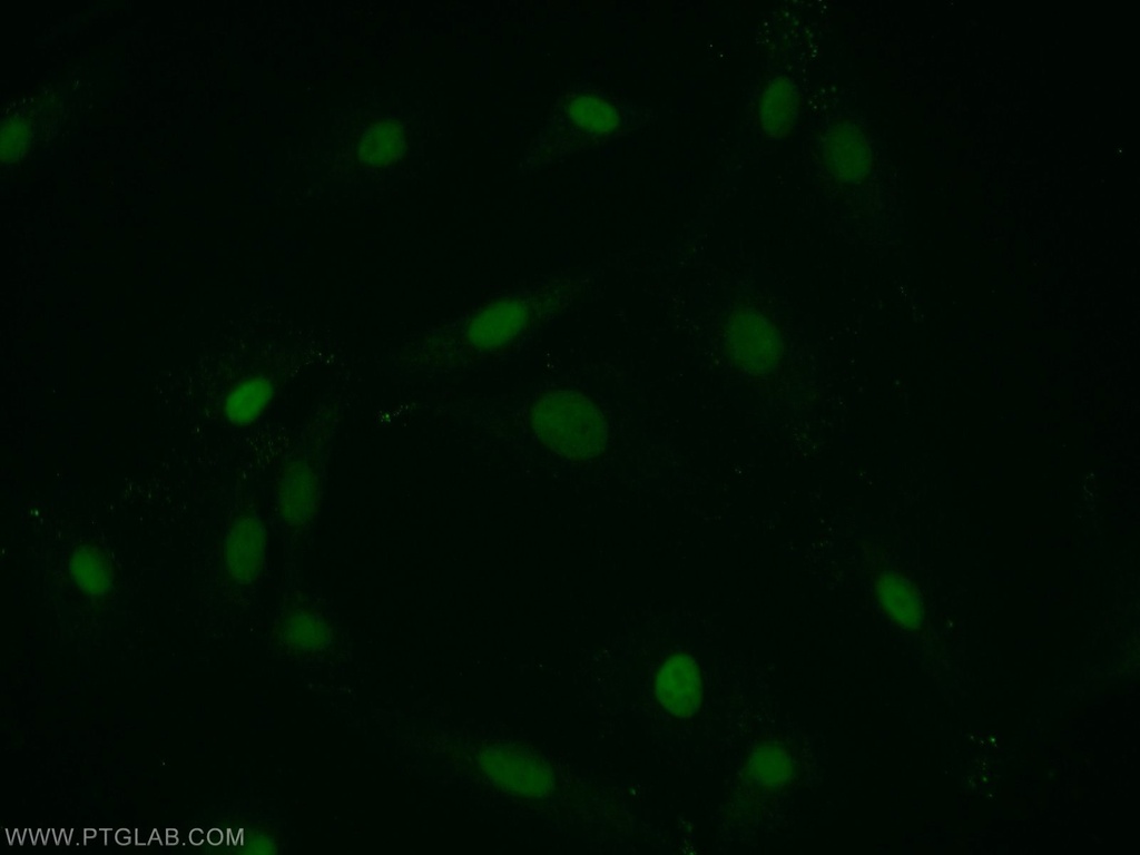 PTMS Polyclonal antibody