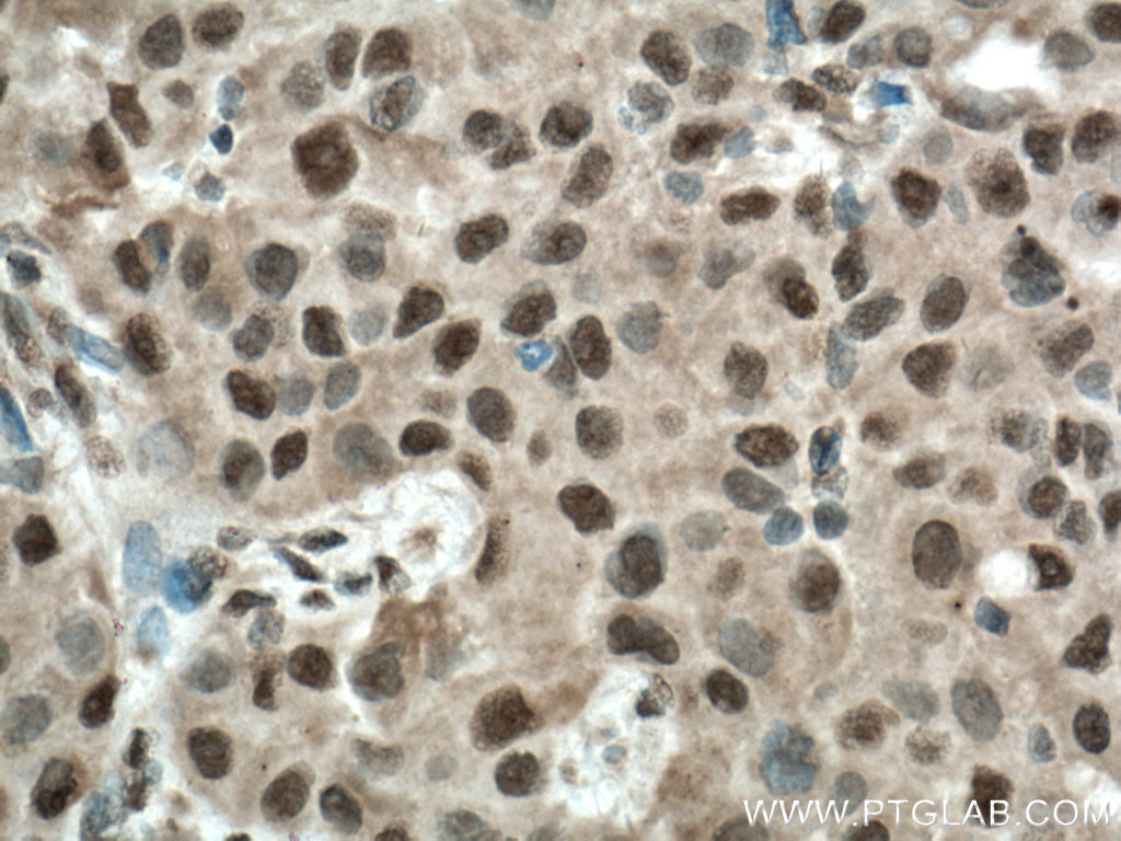 BCOR Polyclonal antibody