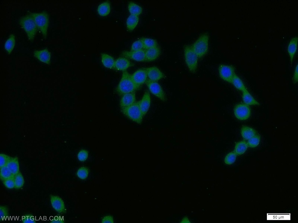 PADI2 Polyclonal antibody