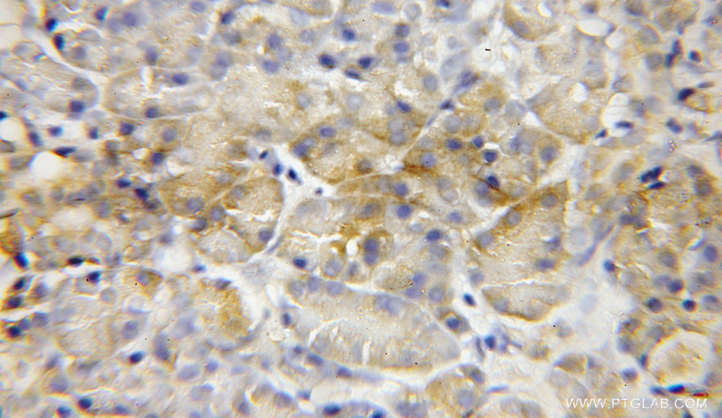 MCCC2 Polyclonal antibody
