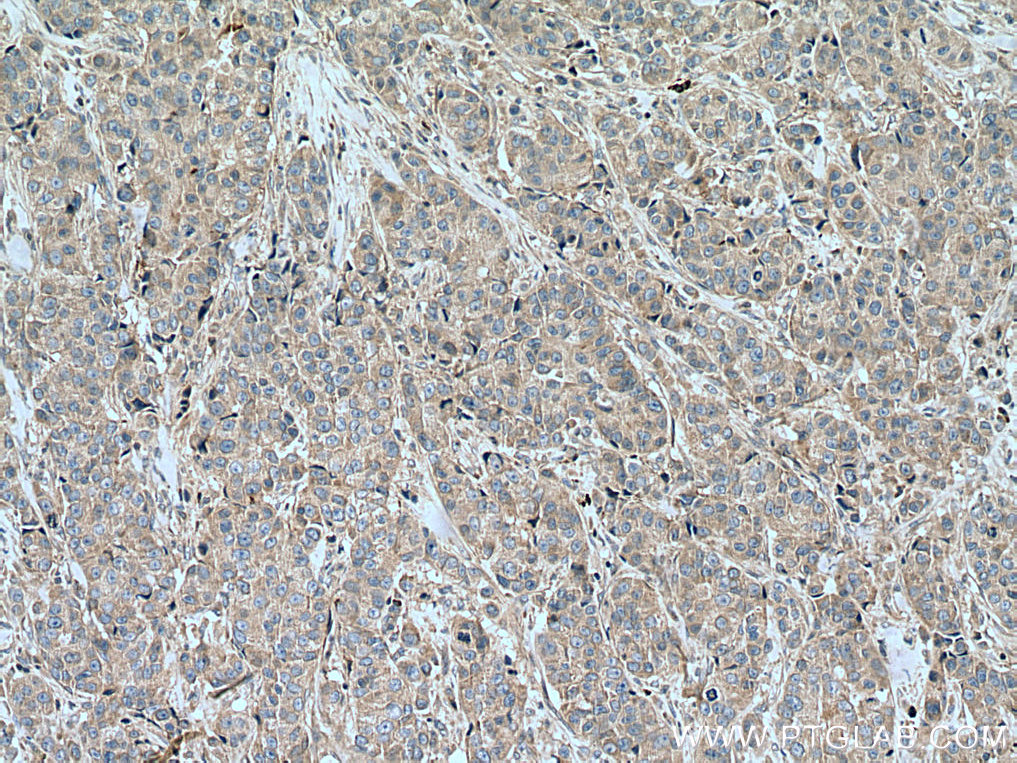 SLC16A5 Polyclonal antibody
