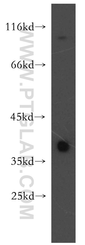 TSPAN5 Polyclonal antibody