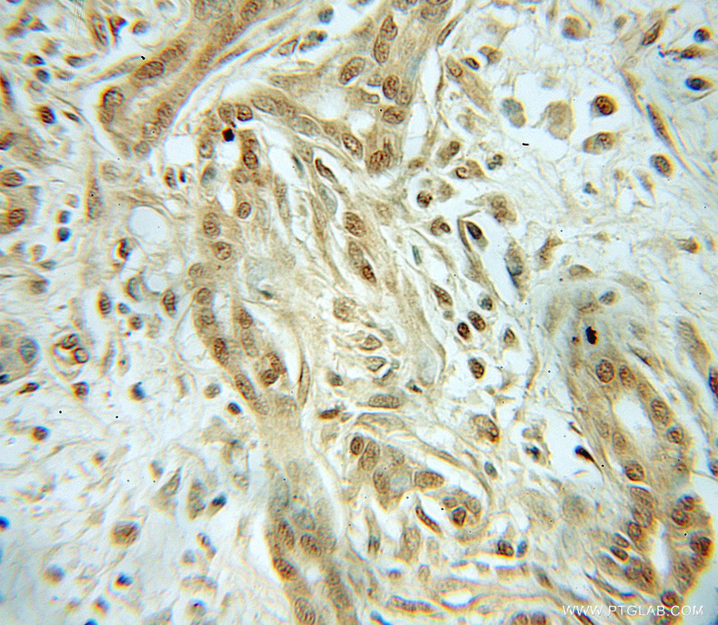 CHRAC1 Polyclonal antibody