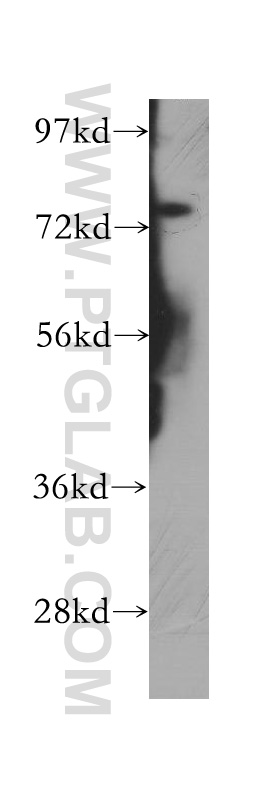 PHF21A Polyclonal antibody