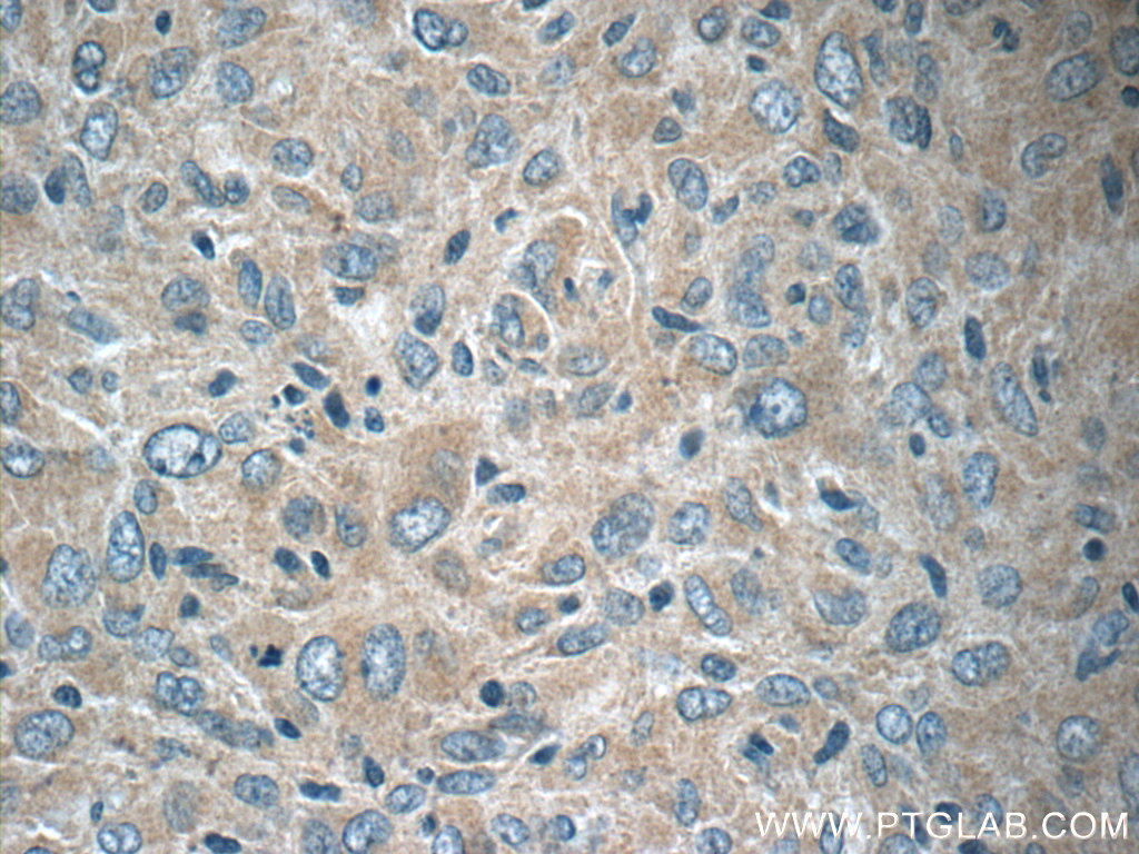 NCKAP1 Polyclonal antibody
