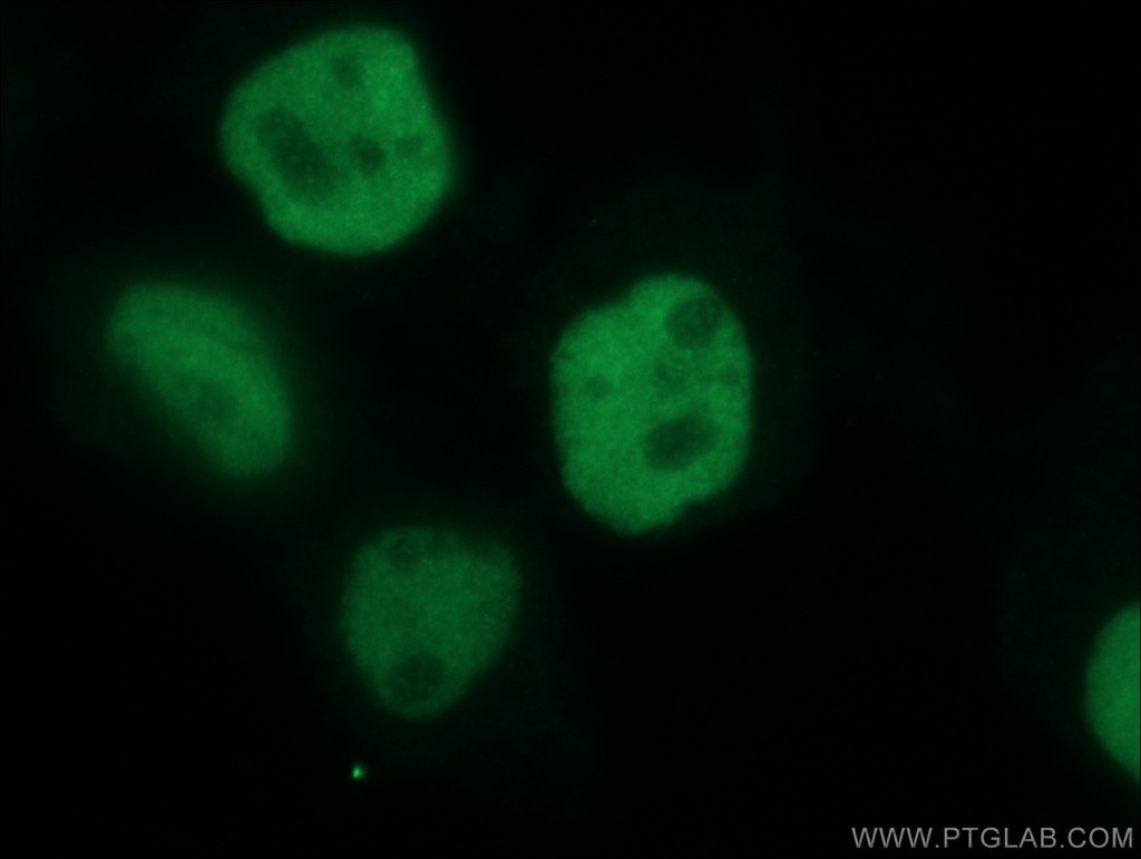 p63 Polyclonal antibody