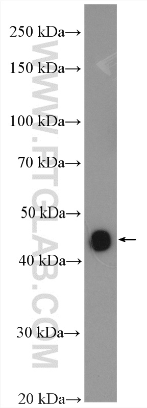 NEIL1 Polyclonal antibody