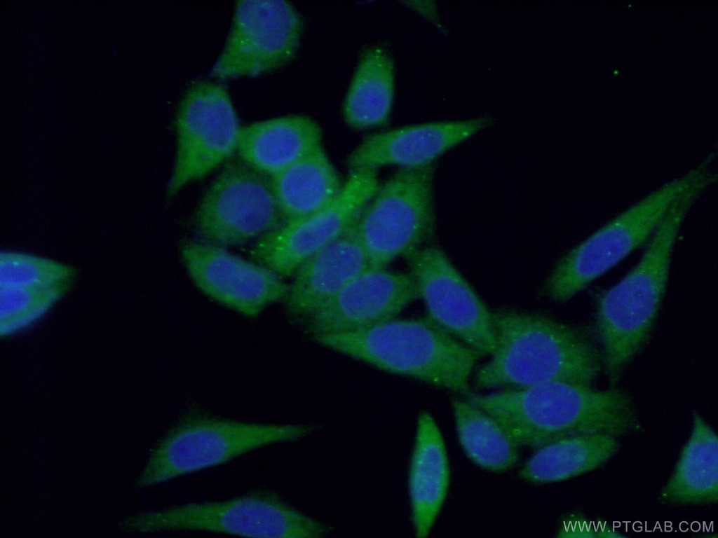 PTS Polyclonal antibody