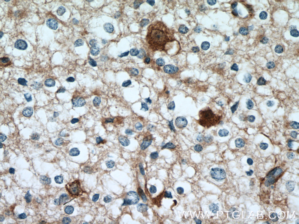 GPRASP2 Polyclonal antibody