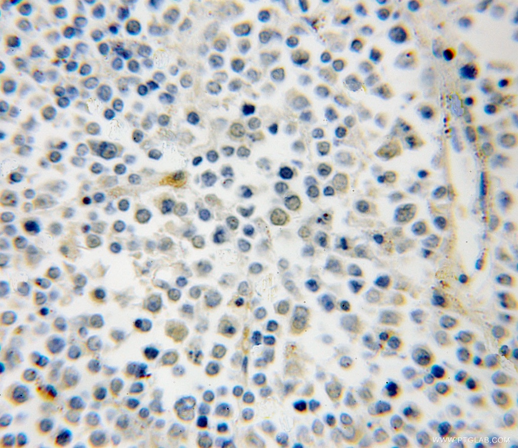 RAB39B Polyclonal antibody