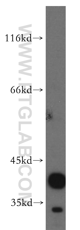 CANT1 Polyclonal antibody