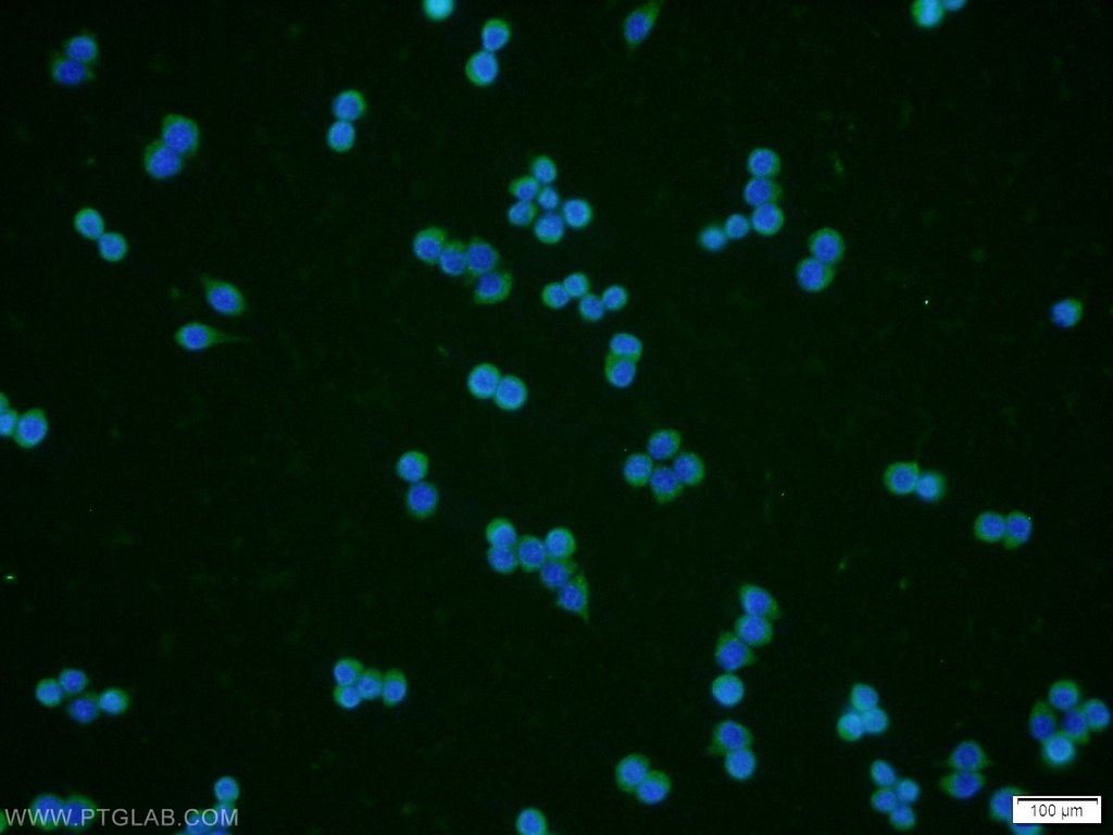 RPE Polyclonal antibody
