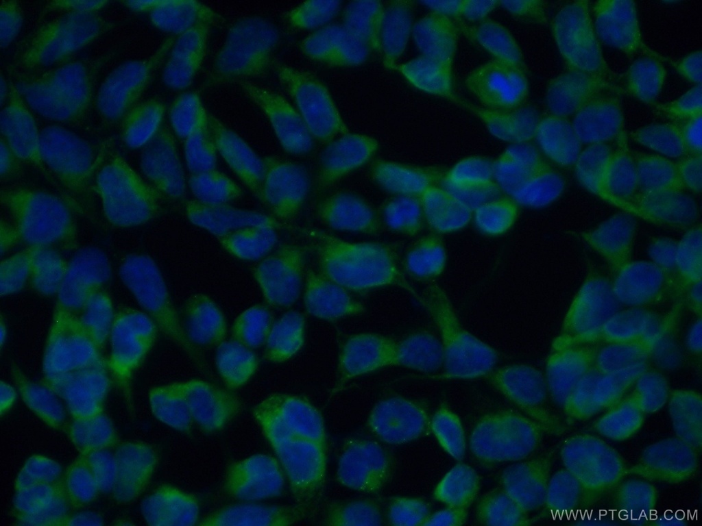 FKBP65 Polyclonal antibody