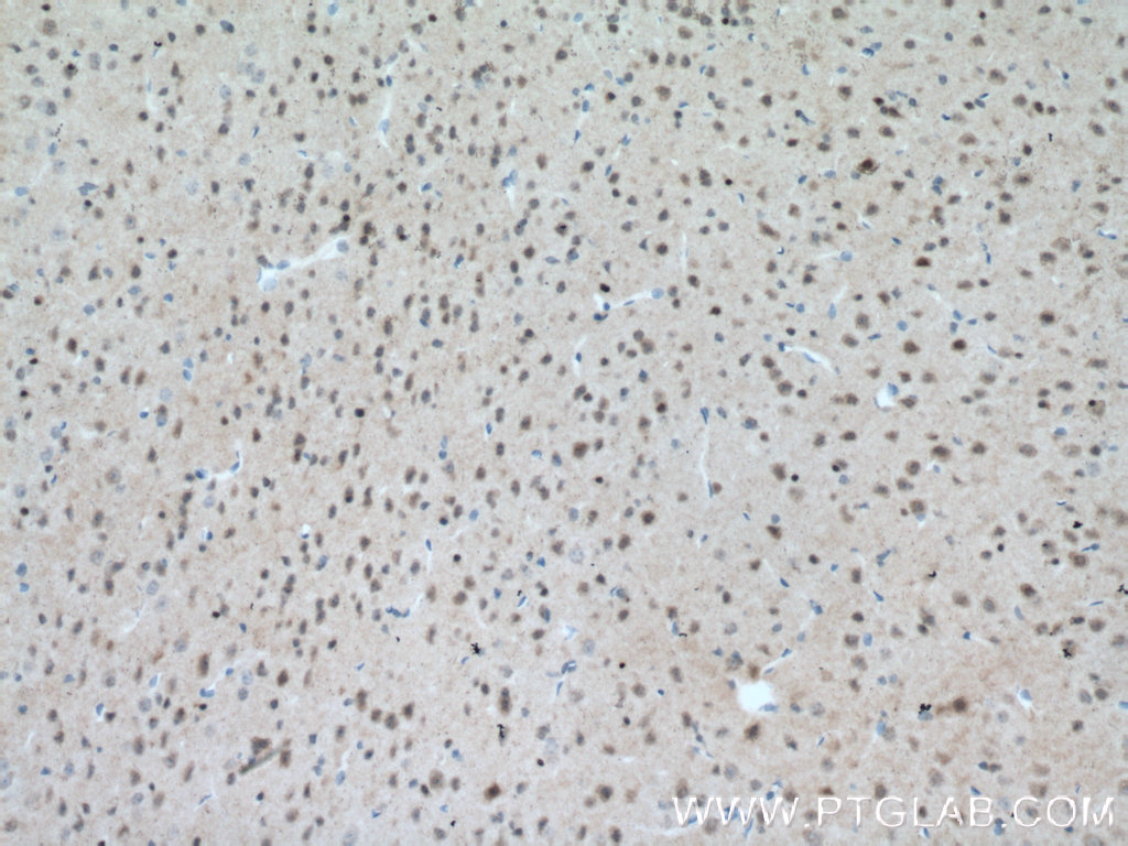 MT3 Polyclonal antibody