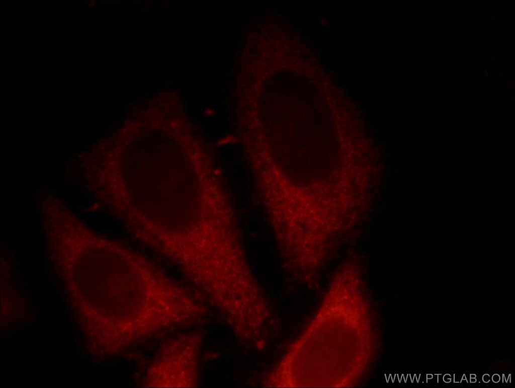 p120 Catenin Polyclonal antibody