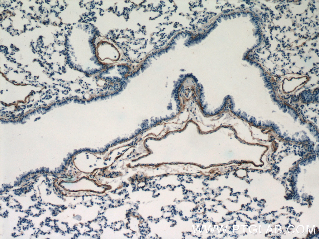 Fibulin 5 Polyclonal antibody